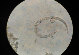 Beneficial Nematodes = Healthy Soil